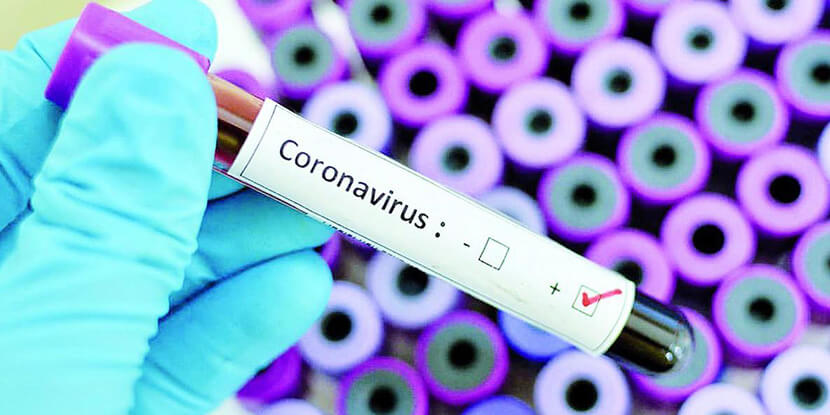 Молекула-коронавируса-COVID-19